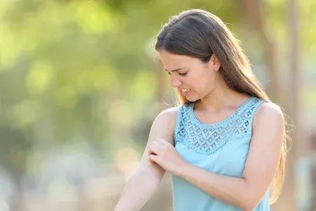 Mosquito bites, woman itching arm